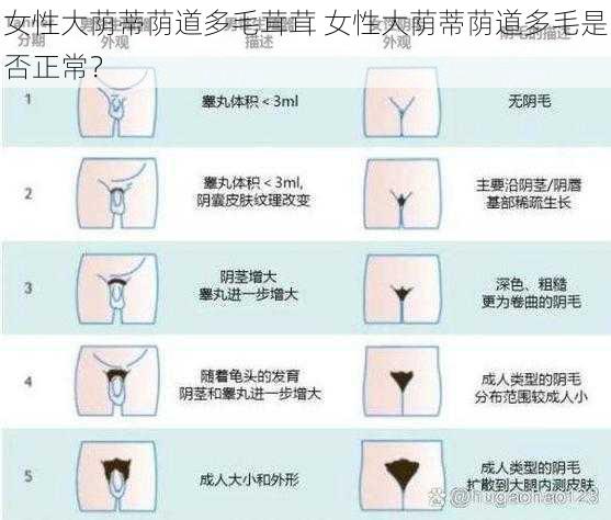 女性大荫蒂荫道多毛茸茸 女性大荫蒂荫道多毛是否正常？