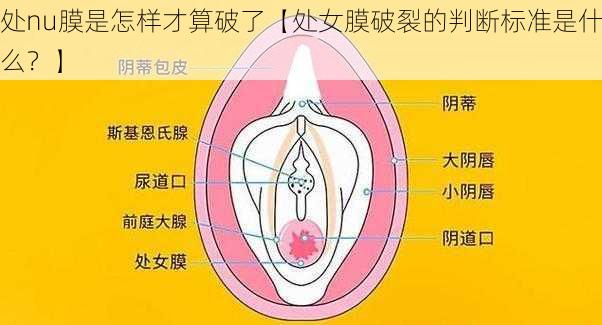 处nu膜是怎样才算破了【处女膜破裂的判断标准是什么？】